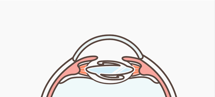 철저한 정밀검사